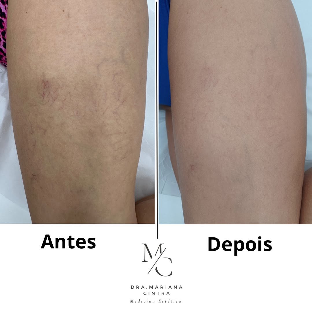 Antes e depois — Dra. Mariana Cintra