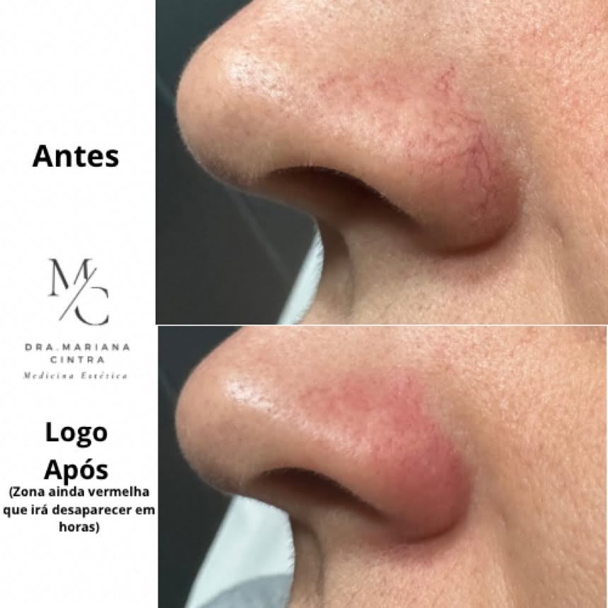 Antes e depois — Dra. Mariana Cintra